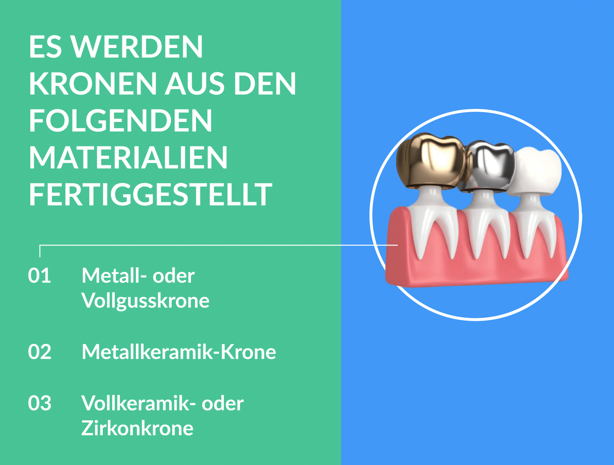 Aus welchem Material wird eine perfekte Zahnkrone angefertigt_