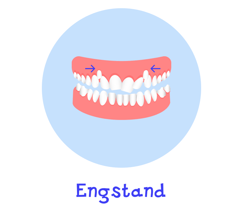Engstand