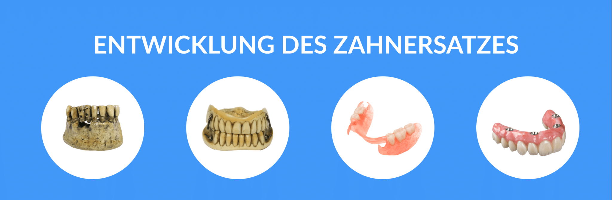 Entwicklung