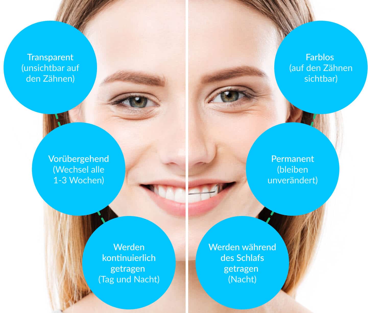 Retainer vs. Aligner