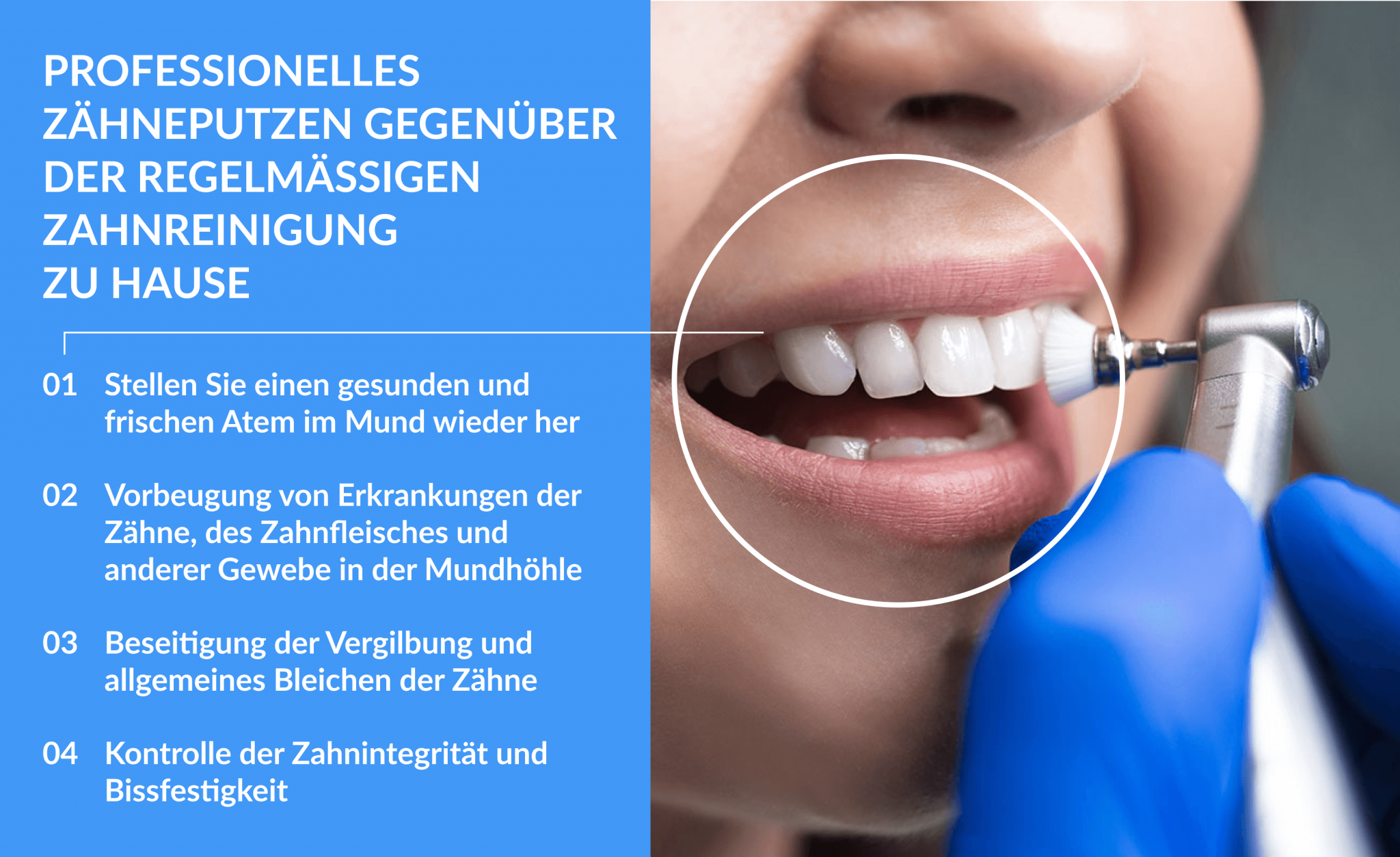 Vorteilen gegenüber der regelmässigen Zahnreinigung zu Hause