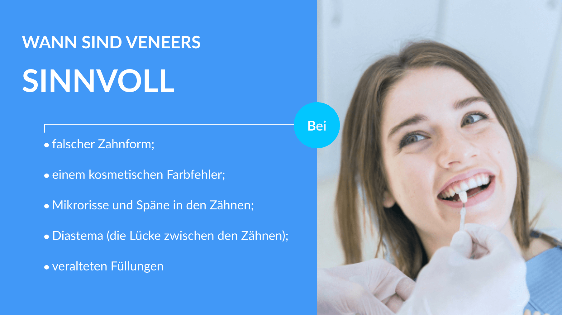 Wann sind Veneers sinnvoll