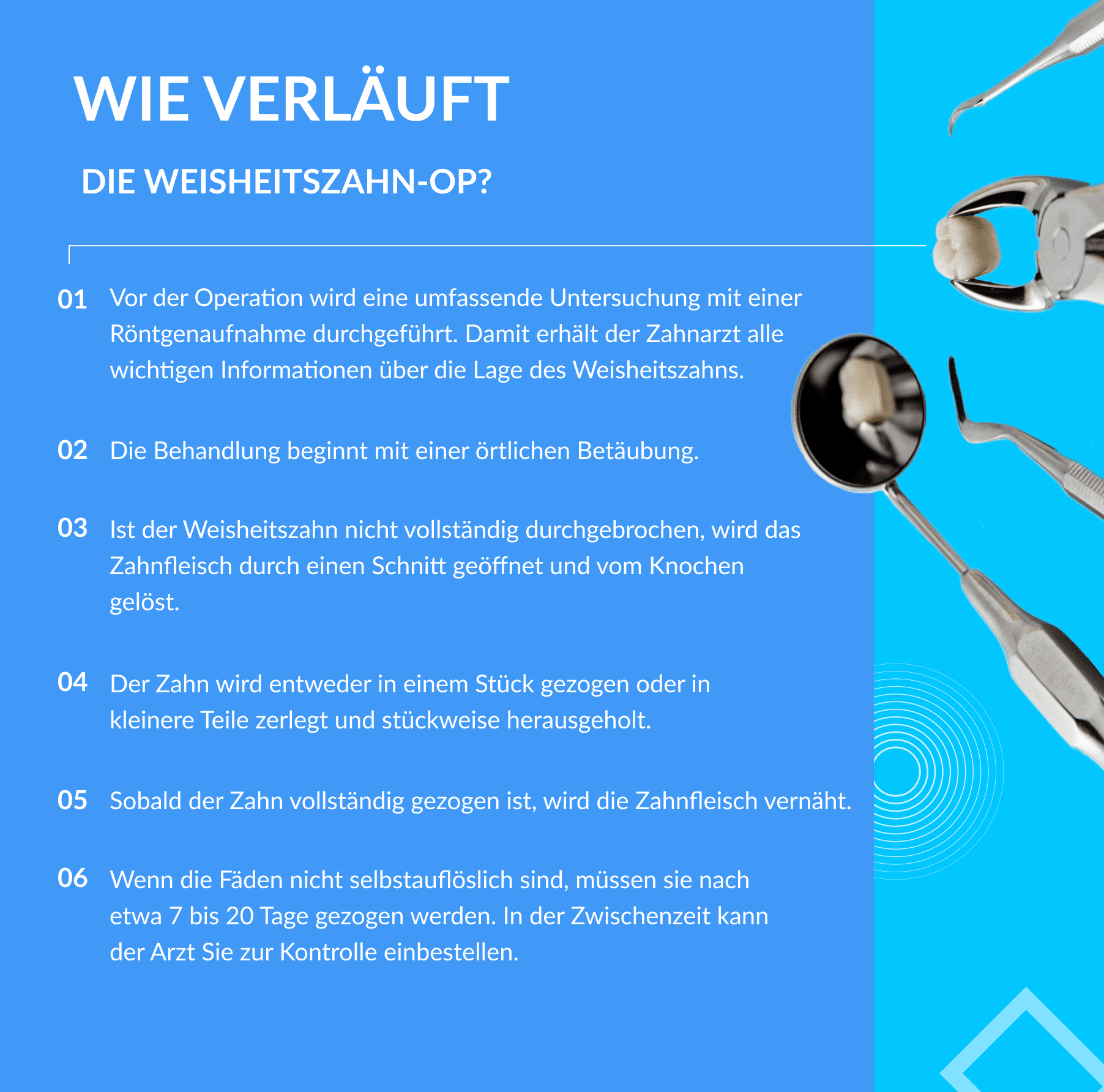 Wie verläuft die Weisheitszahn-OP_