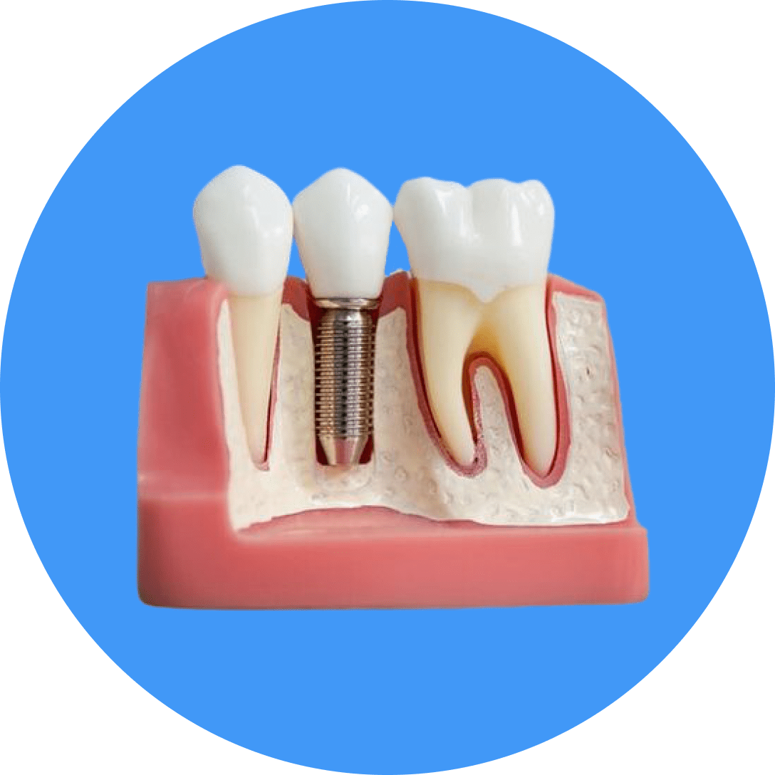 implant icon