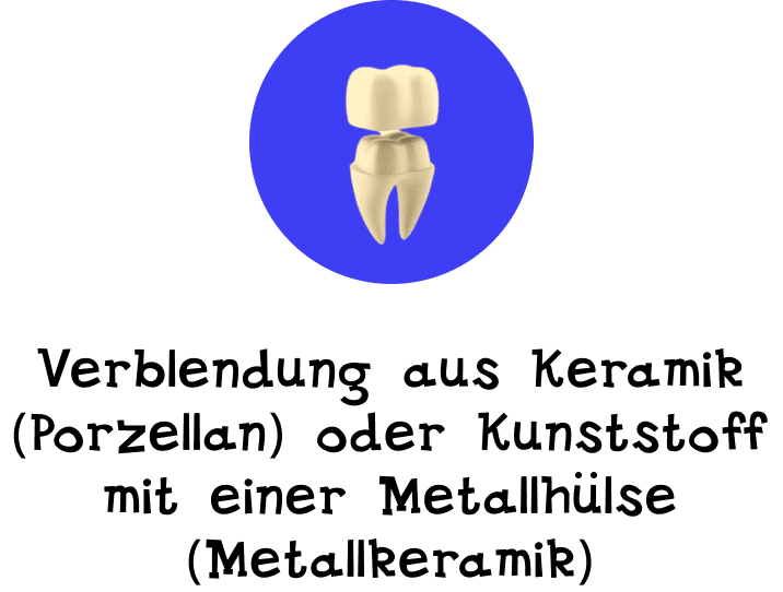 keramikkrone
